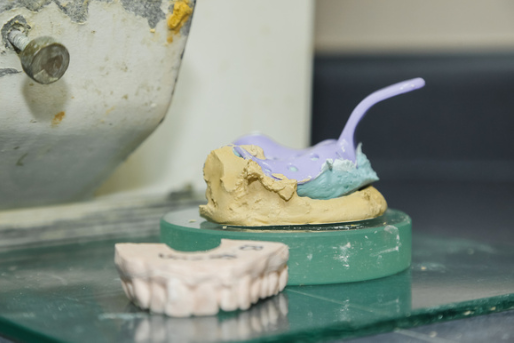 A dental impression and model sit on a table, possibly hinting at an Invisalign fitting. The impression tray is blue and purple, contrasting the beige model. Set in a busy dental clinic or laboratory, various equipment is visible in the background.