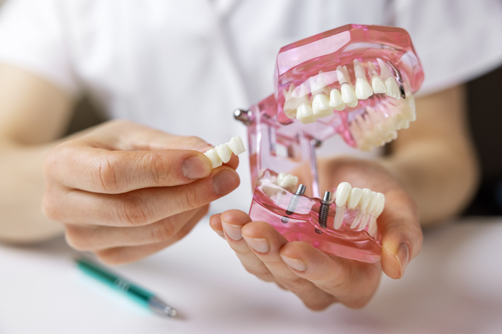 A person holds a dental model of teeth in one hand and a dental bridge in the other, demonstrating bridges and dental prosthetics. A pen lies on the table in the background.