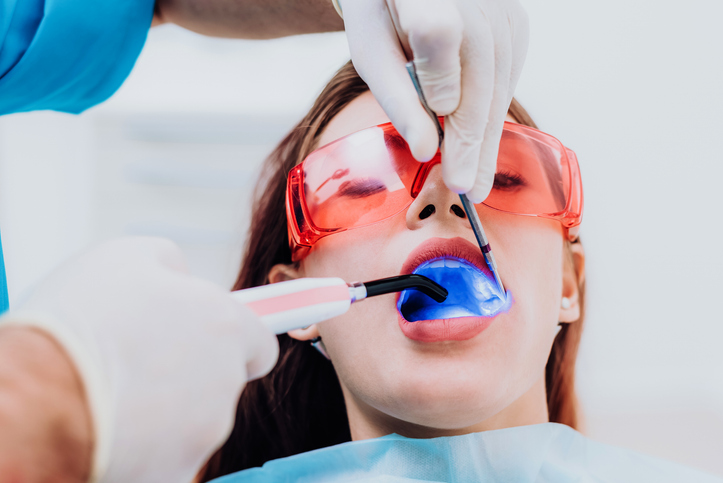 A person wearing protective red glasses receives dental treatment. A dentist, wearing gloves, uses dental tools and a curing light while placing tooth-colored fillings. The patient is reclined and covered with a dental bib.