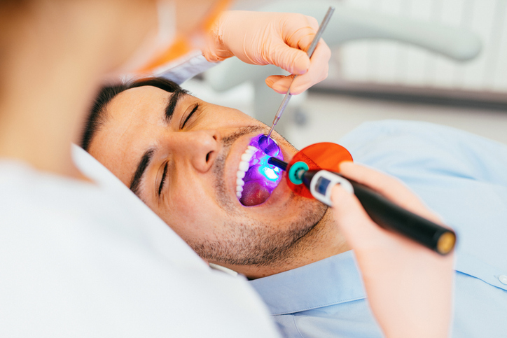 A dentist uses a curing light on a male patient’s teeth during a tooth filling procedure, while the patient reclines in the dental chair with his mouth open.