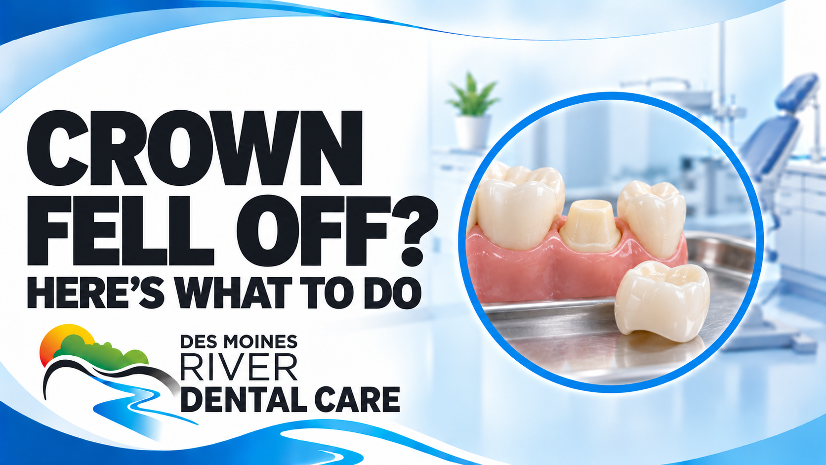 What to Do If Your Dental Crown Falls Off